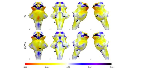 3D projections of QSM maps on the rendered brainstem