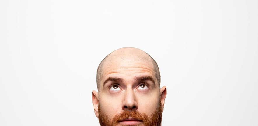 Bald young man, front view 