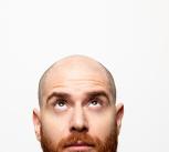Bald young man, front view 